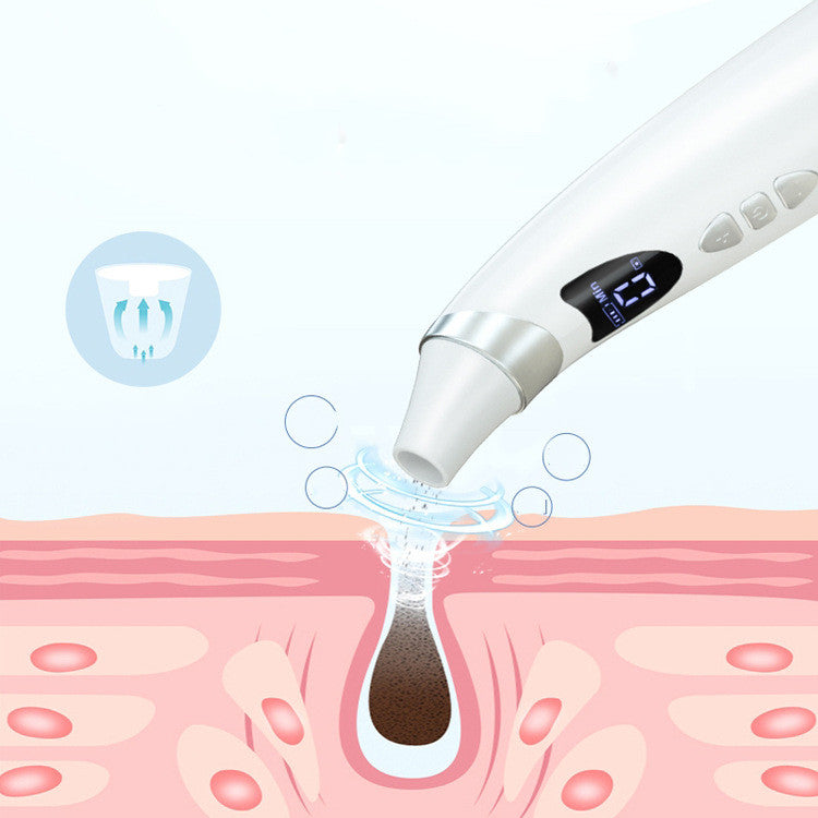 Electric Blackhead Remover – Deep Pore Cleansing & Acne Removal Tool