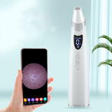 Electric Blackhead Remover – Deep Pore Cleansing & Acne Removal Tool