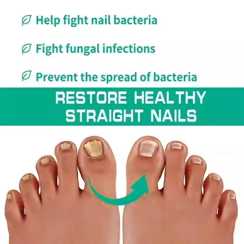 Nail & Foot Fungus Treatment Serum – Repair and Restore Healthy Nails
