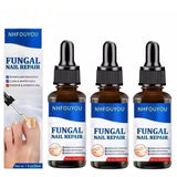 Nail & Foot Fungus Treatment Serum – Repair and Restore Healthy Nails